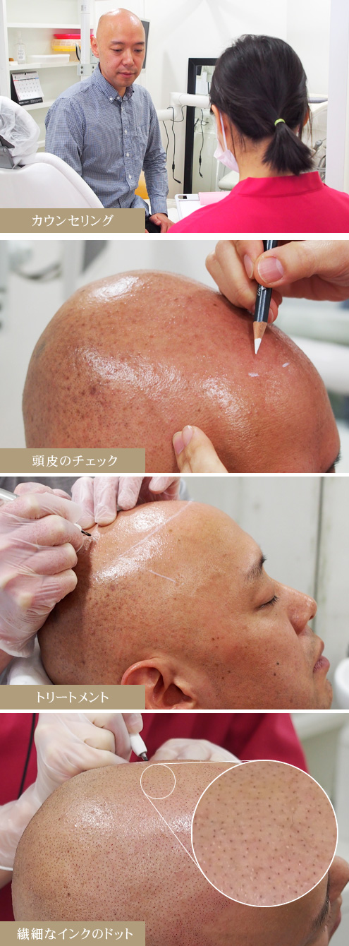 ヘアタトゥー、パッチテストの流れ