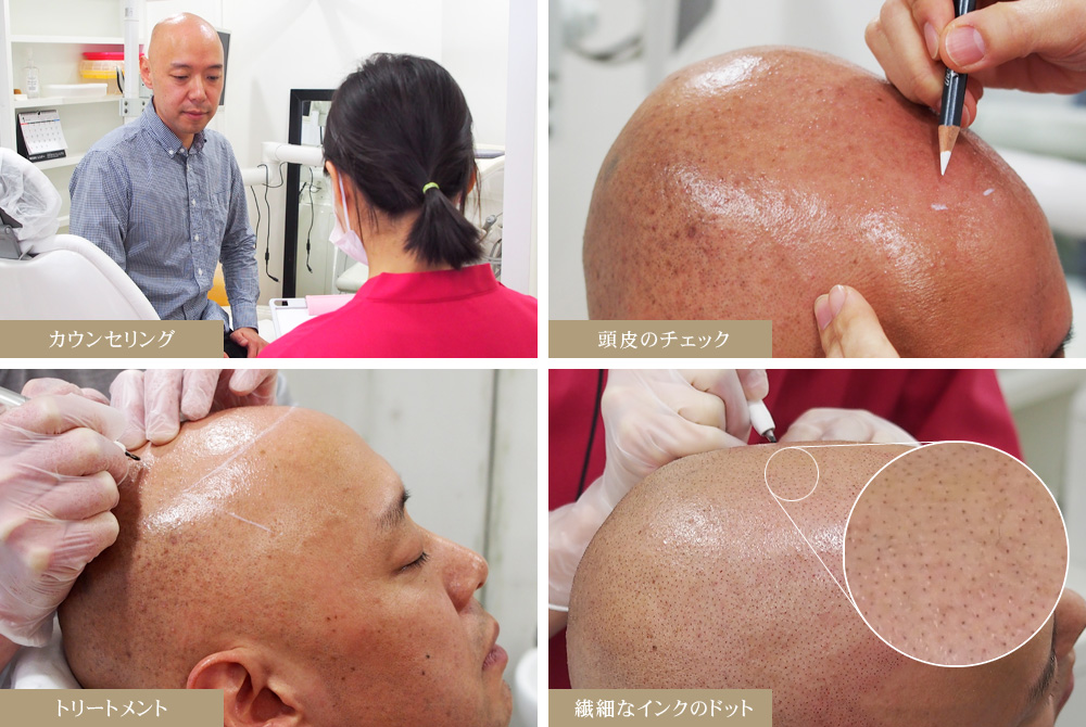 ヘアタトゥー、パッチテストの流れ