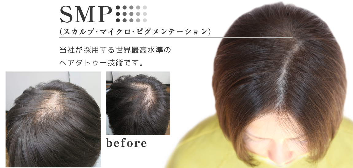 女性のトリートメント