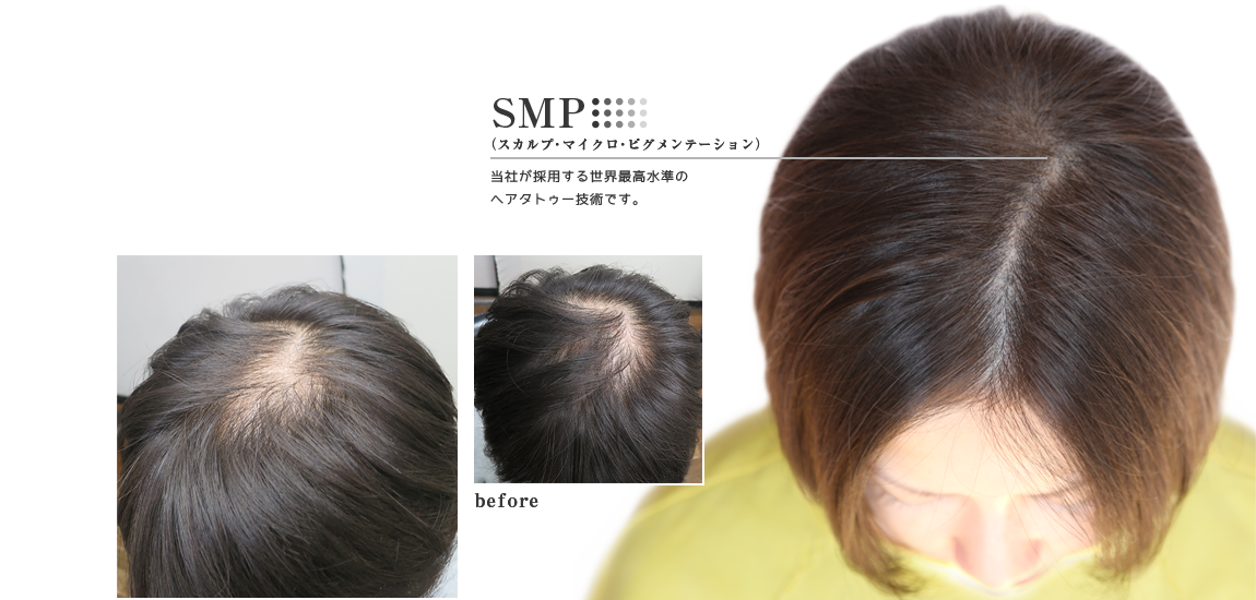 女性のトリートメント