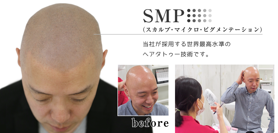 男性のトリートメント