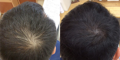 ライトユーザーにも最適